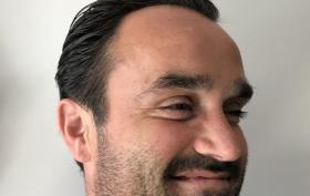 Botox_voor_en_na.jpg